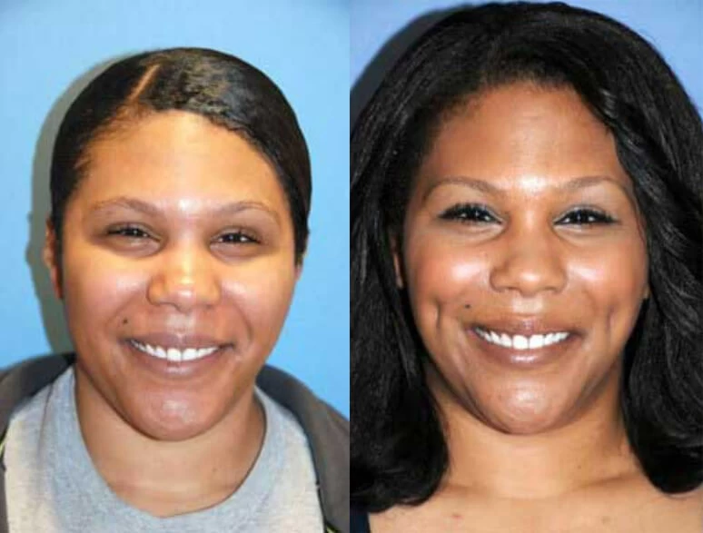 Dimple Creation2.webp